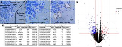 Transcriptomic analysis of isolated and pooled human postmortem cerebellar Purkinje cells in autism spectrum disorders